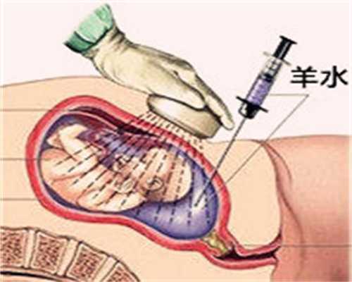 香港时代化验所验血准确吗,非月经期阴道出血是怎么回事