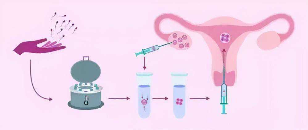 香港验血鉴别胎儿多少钱,多年难孕难育夫妻进行辅助生殖助孕