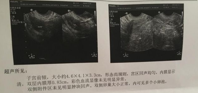 香港验血报告官网能查得到,泰国试管婴儿生一对双胞胎费用要多少钱？